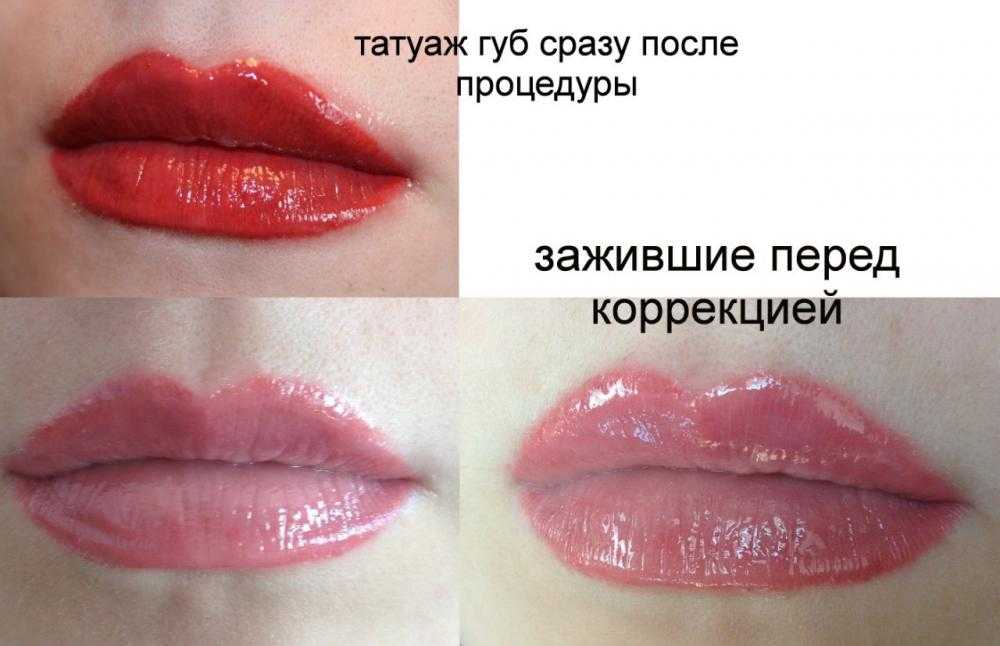 Заживление губ по дням фото