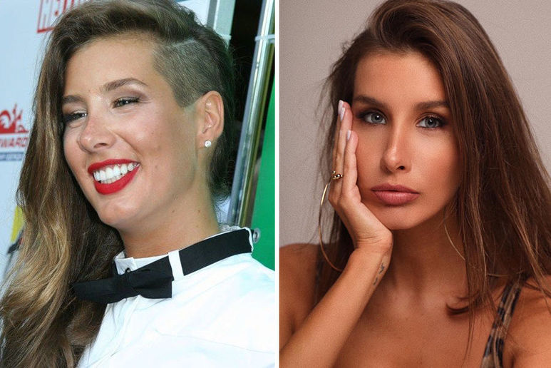 Кэти топурия до и после операции Кэти Топурия до и после