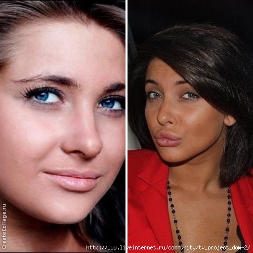 Эльчин афаджан похудела до и после фото