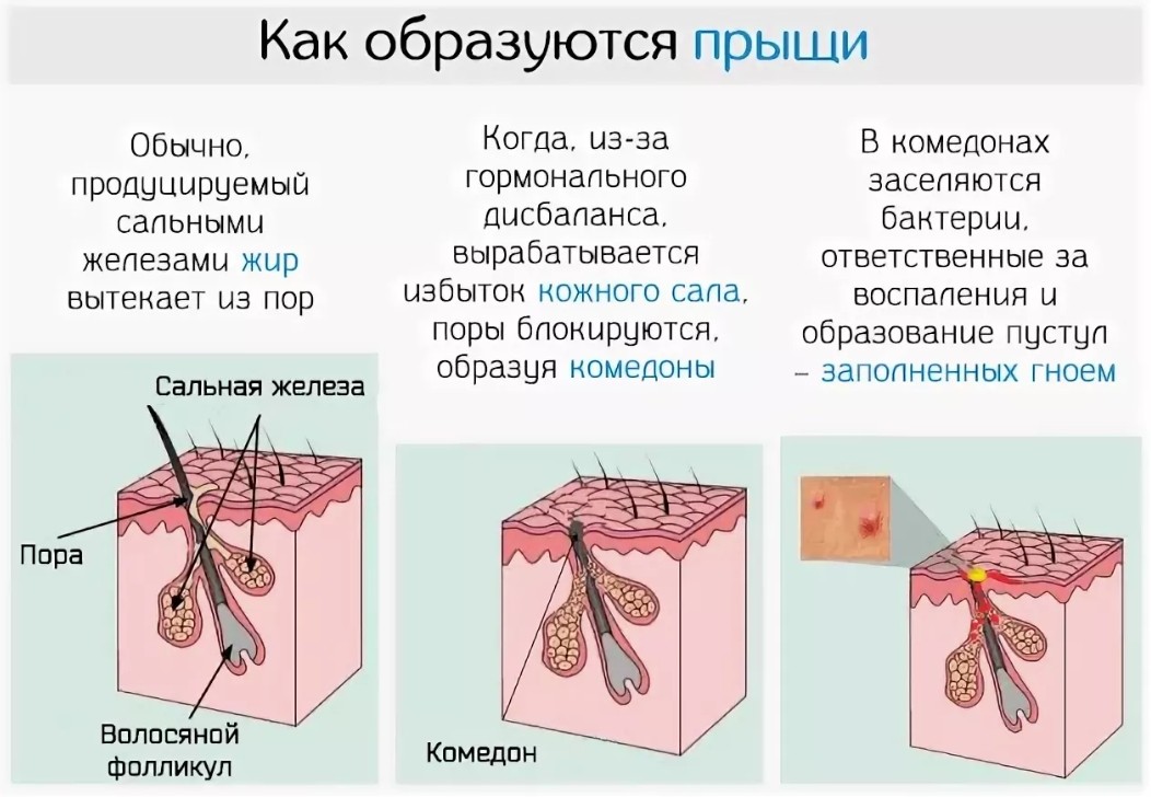 Green hill сыпь чем лечить