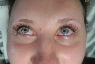 Покраснение глаз после наращивания ресниц – причины и способы устранения
