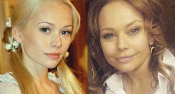 Корикова елена последние фото до и после операции