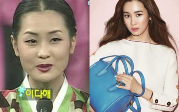Корейские актеры до и после пластики фото