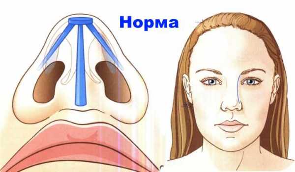 Перелом костей носа карта вызова локальный статус