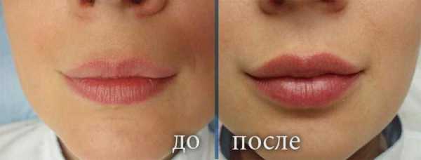 Татуаж контура губ фото до и после