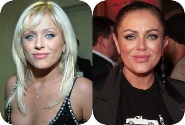 Юлия началова фото до и после пластики лица фото Юлия